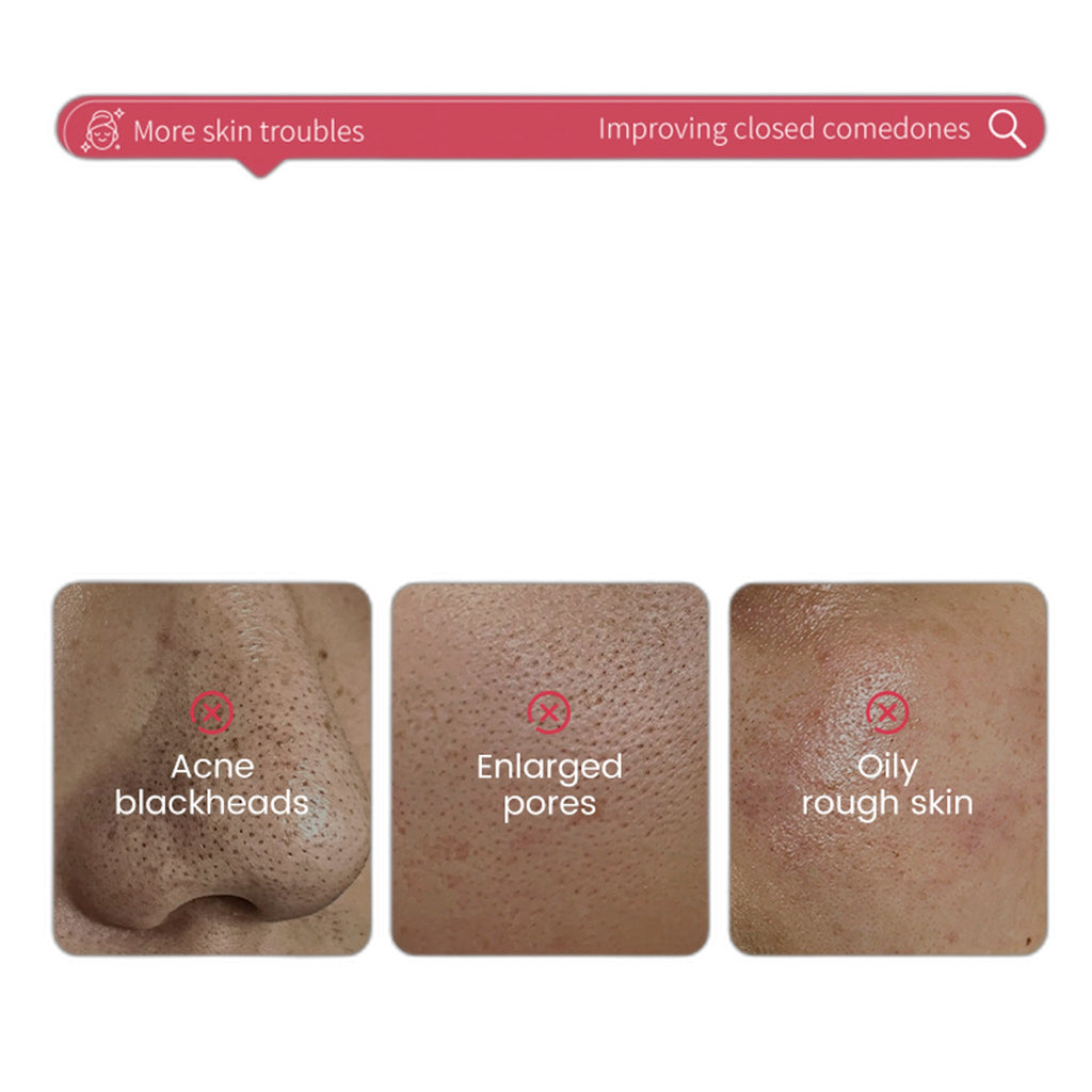 HUNMUI Volcanic Mud Cleansing Balm Stick 40g