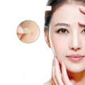 Purifying Face Patches - 144PCS for Clear Skin