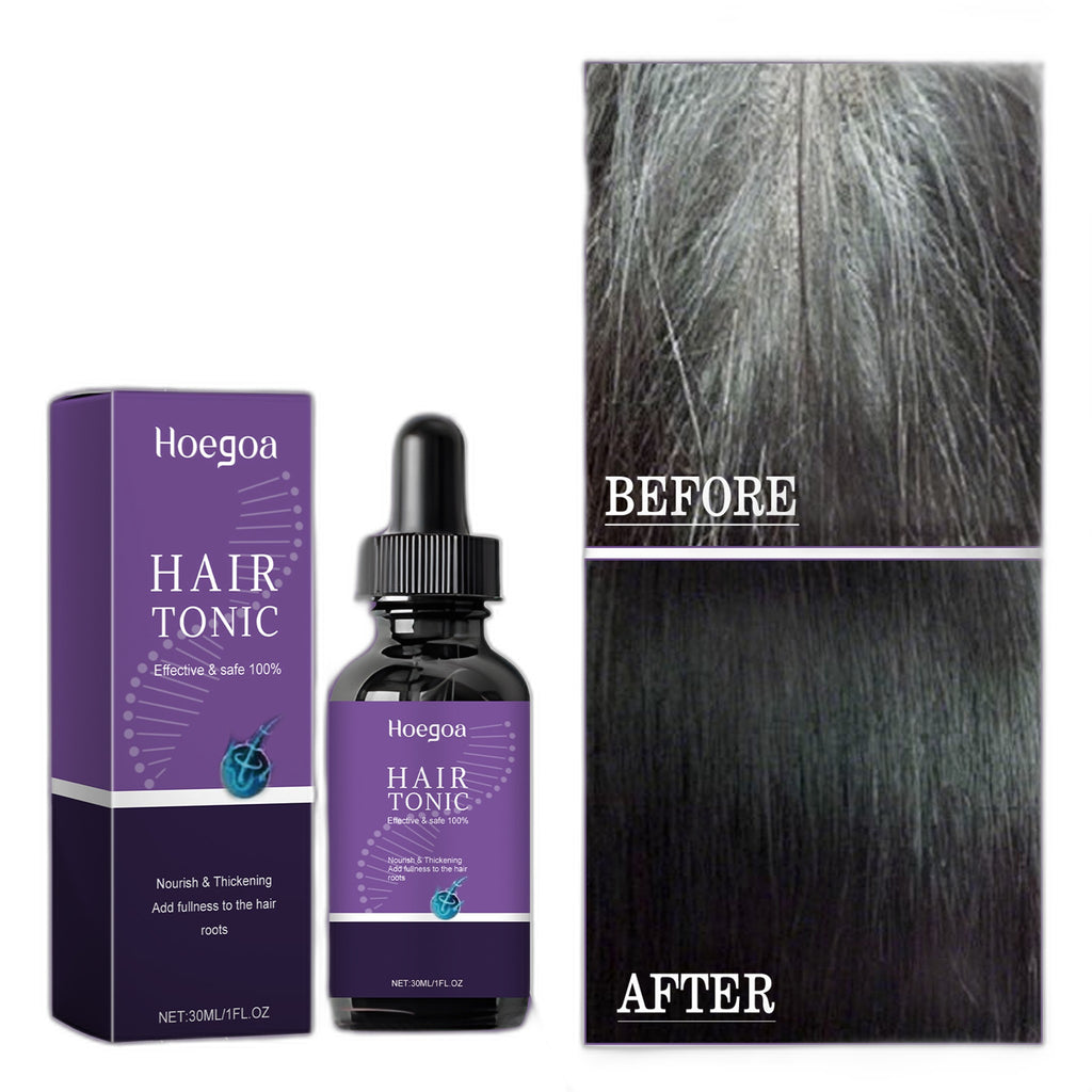 Revitalize Your Hair with Our Hair Growth Serum 30ml