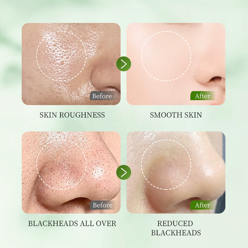 HUNMUI Whitening Exfoliating Gel Moisturizer - 50g
