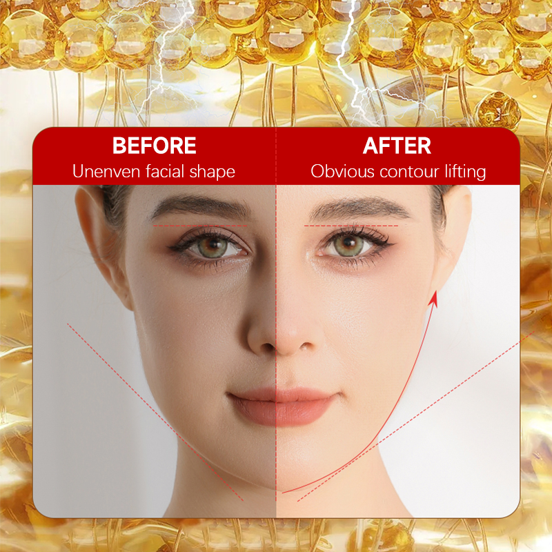 V-Shaped Face Contour Massager - EMS Microcurrent Roller