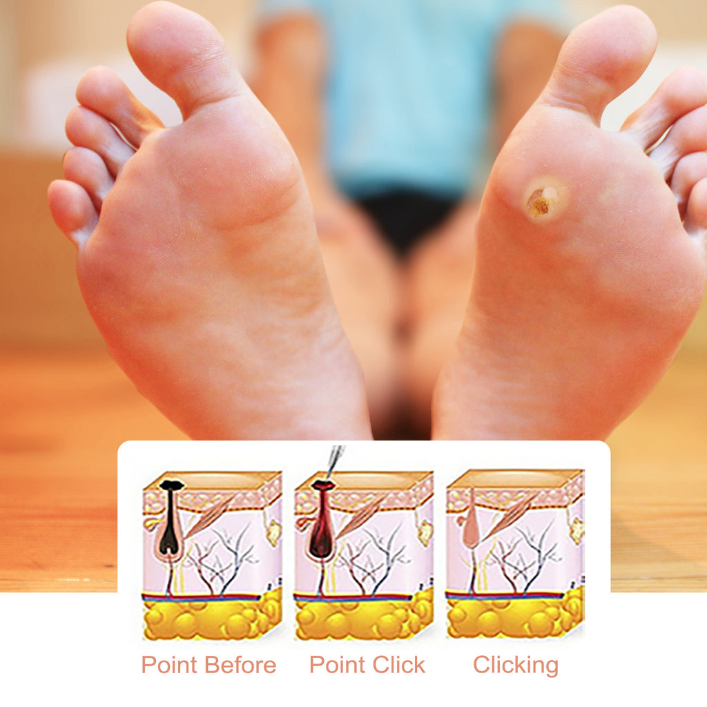 SOUTH MOON Foot Care Solution - Cleanses and Moisturizes Skin
