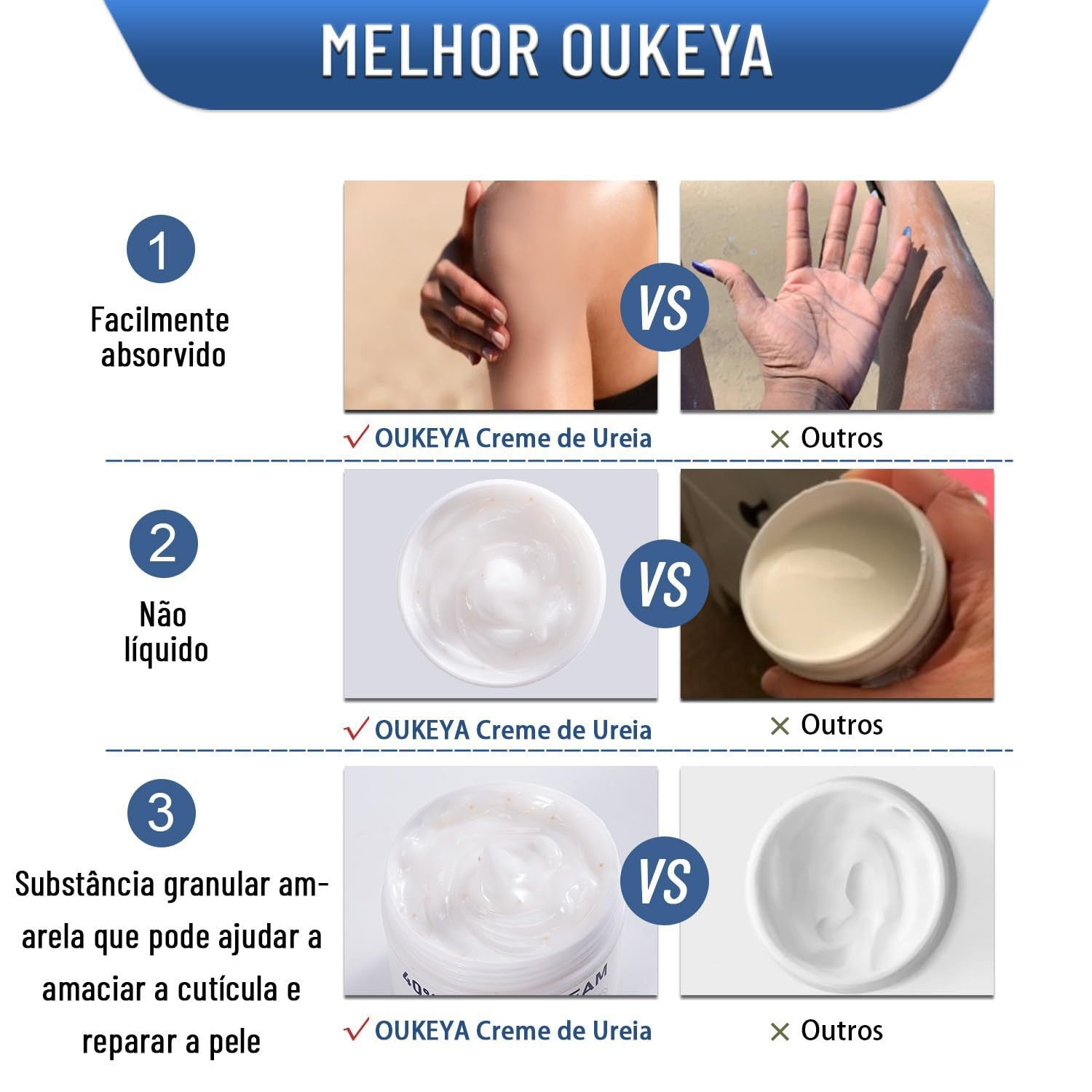 Urea Cream Moisturizing Hand and Foot Cream for Dryness Prevention